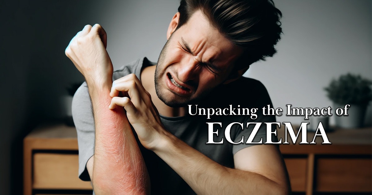 Exploring the Rise of Eczema in the U.S. From Diet to Environment, Image of a man vigorously scratching his arm in pain due to eczema condition.
